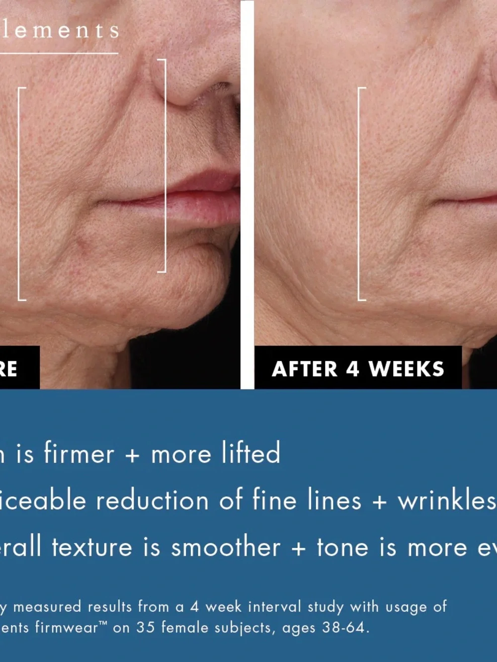 Bioelements | Firmwear Biotech Firm + Lift Serum